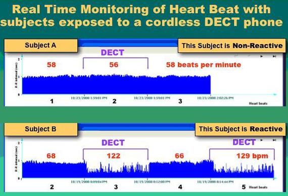 ETUDE : les téléphones sans fil DECT (et le WiFi) provoquent des irrégularités cardiaques - 23/10/2010