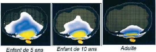 Source: Gandhi, O.P., G. Lazzi, et C.M. Furse. IEEE Transactions on Microwave Theory and Techniques, 1996.