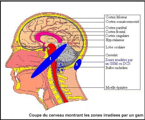 'Des experts dénoncent les risques du portable' - Le Figaro -  22/01/2004