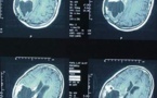 Augmentation de 50% des tumeurs du cerveau chez les enfants au Royaume-Uni en 10 ans + 40% au Danemark, en Finlande - explosion du phénomène en France - 30/05/2012